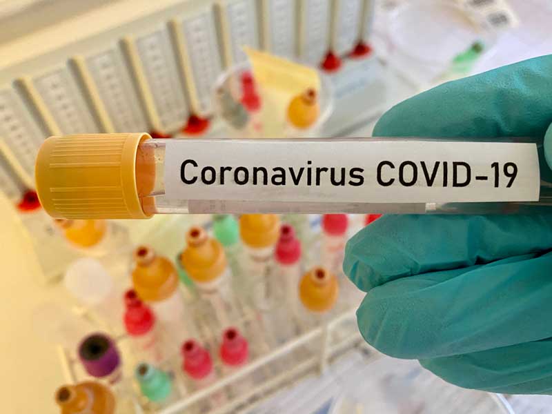 coronavirus covid19